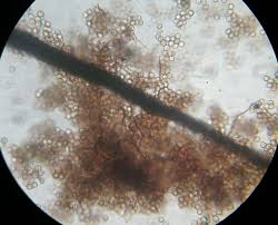 Attēlu rezultāti vaicājumam “Reticularia lobata spores”