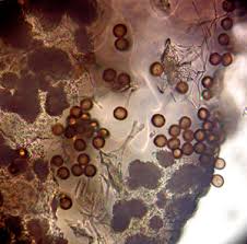 Attēlu rezultāti vaicājumam “Lycogala ustulatum”