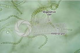 Attēlu rezultāti vaicājumam “Nostoc commune cells”