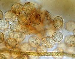 Attēlu rezultāti vaicājumam “Trichia alpina spores”