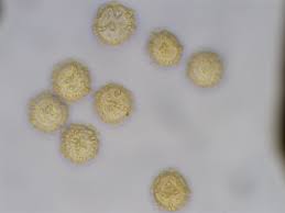 Attēlu rezultāti vaicājumam “Oligonema persimile spores”