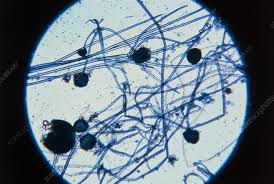 Attēlu rezultāti vaicājumam “Lophozia badensis sporophyte”