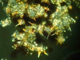 Attēlu rezultāti vaicājumam “Didymium tussilaginis spores”