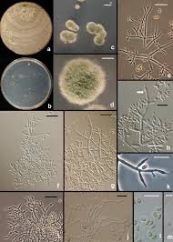 Attēlu rezultāti vaicājumam “Hypocrea rufa”