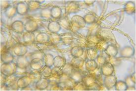 Attēlu rezultāti vaicājumam “Perichaena depressa”