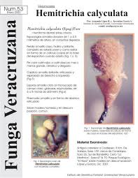 Attēlu rezultāti vaicājumam “Hemitrichia calyculata”