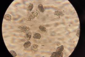 Attēlu rezultāti vaicājumam “Pucciniastrum areolatum”