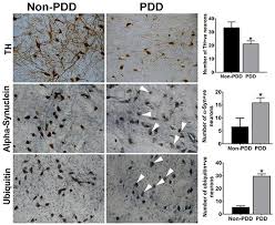 Image result for Calne Alpha 4