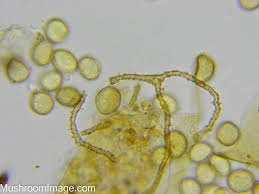 Attēlu rezultāti vaicājumam “Perichaena corticalis spores”