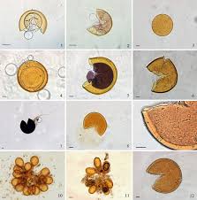 Attēlu rezultāti vaicājumam “Amaurochaete fusiformis spores”