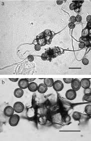 Attēlu rezultāti vaicājumam “Clastoderma debaryanum spores”