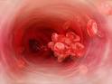 DVT | Deep Vein Thrombosis | Blood Clot
