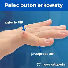 Znalezione obrazy dla zapytania palec