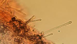 Attēlu rezultāti vaicājumam “Lachnum corticale”