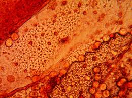 Attēlu rezultāti vaicājumam “Lycogala ustulatum macro”