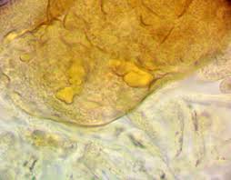 Attēlu rezultāti vaicājumam “Lycogala asperum”