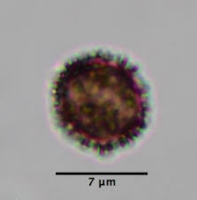 Attēlu rezultāti vaicājumam “Physarum diderma”