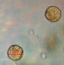 Attēlu rezultāti vaicājumam “Trichia longipalpis sessile”