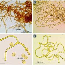 Attēlu rezultāti vaicājumam “Tubifera ferruginosa (subsp. ferruginosa) spores”