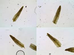 Attēlu rezultāti vaicājumam “Gyroweisia tenuis”