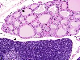 Image result for Thymus