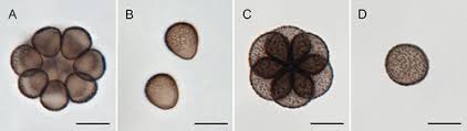 Attēlu rezultāti vaicājumam “Diachea muscorum spores”
