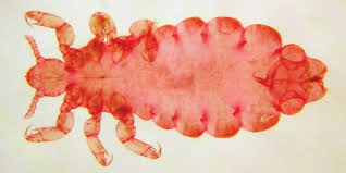 Attēlu rezultāti vaicājumam “Licea pygmaea sessile”