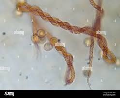 Attēlu rezultāti vaicājumam “Trichia contorta”