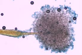 Attēlu rezultāti vaicājumam “Clastoderma debaryanum spores”