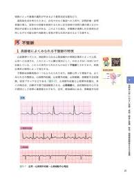 「却って永井さんのせん妄悪化した風」的圖片搜尋結果