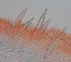 Attēlu rezultāti vaicājumam “Physarum auriscalpium spores”
