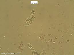 Attēlu rezultāti vaicājumam “Ruzenia spermoides”