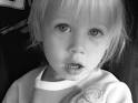 has developmental delays .