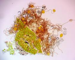 Attēlu rezultāti vaicājumam “Hemitrichia sordivesiculosa macro”