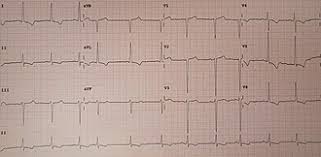 Image result for  ^ L V [ h    