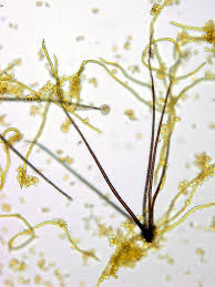 Attēlu rezultāti vaicājumam “Trichia scabra spores”