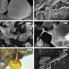 Attēlu rezultāti vaicājumam “Arcyria globosa”