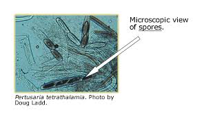 Attēlu rezultāti vaicājumam “Licea minima spores”