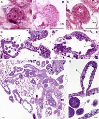 Attēlu rezultāti vaicājumam “Leucochloridium paradoxum larva”