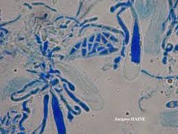 Attēlu rezultāti vaicājumam “Cliostomum corrugatum”