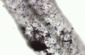 Attēlu rezultāti vaicājumam “Stemonitis axifera spores”