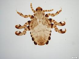 Attēlu rezultāti vaicājumam “Licea pygmaea sessile”