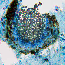 Attēlu rezultāti vaicājumam “Lichenoconium xanthoriae”