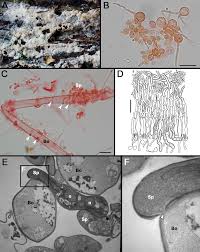 Attēlu rezultāti vaicājumam “Tranzschelia pruni-spinosae spores”