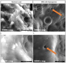 IRE 0.0 IRE 7.5에 대한 이미지 검색결과