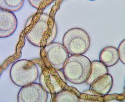 Attēlu rezultāti vaicājumam “Gulielmina vermicularis”