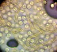 Attēlu rezultāti vaicājumam “Arcyria imperialis stalked”