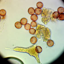 Attēlu rezultāti vaicājumam “Physarum bryomacrocarpum spores”