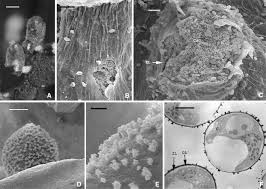 Attēlu rezultāti vaicājumam “Diachea leucopodia stalked”