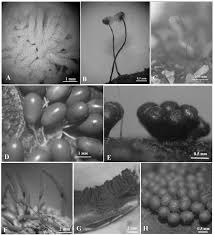 Attēlu rezultāti vaicājumam “Symphytocarpus impexus plasmodium”